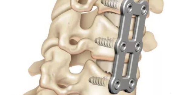 Contact Top Neuro Spine Surgeon in India: Meet the Best Cervical Spine Surgeon 1 Contact Top Neuro Spine Surgeon in India: Meet the Best Cervical Spine Surgeon